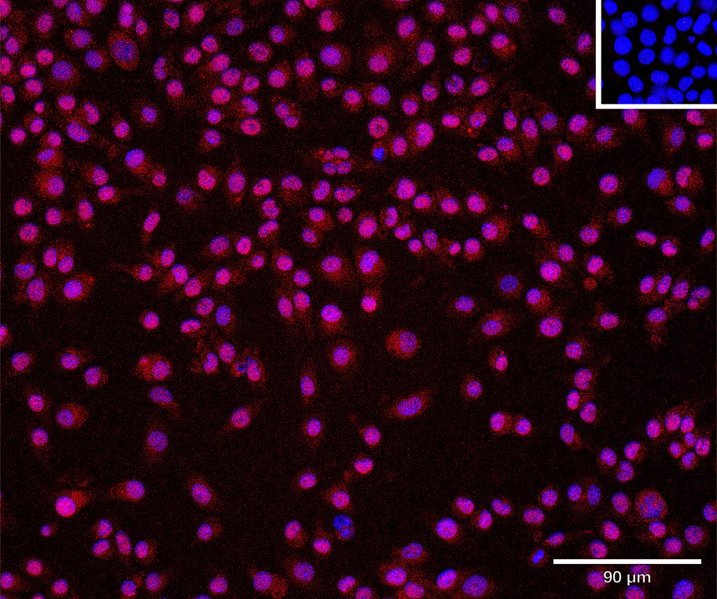 Ankyron SFTPA_MOUSE Clone CA30166