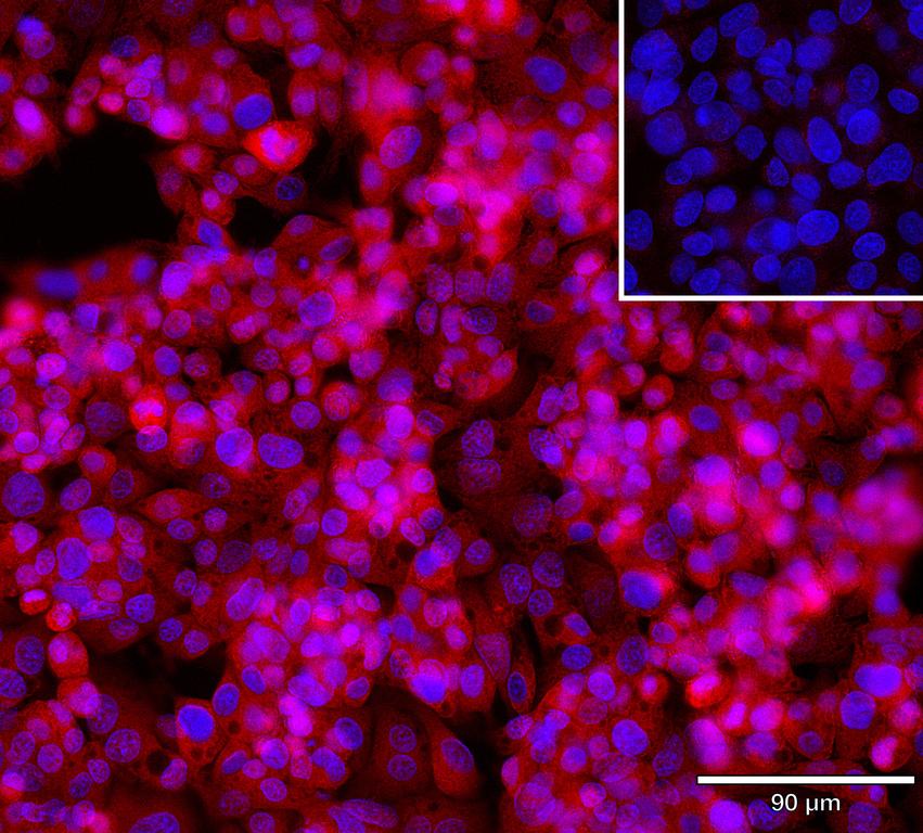 Ankyron SG3A1_HUMAN Clone AS40982