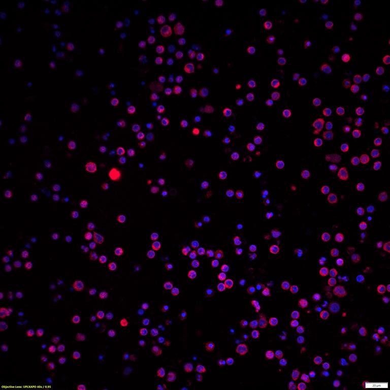Ankyron SH21A_HUMAN Clone DZ30241