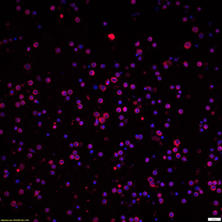 Ankyron SH21A_HUMAN Clone DZ30240