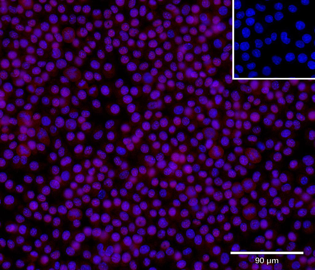 Ankyron SIAT1_MOUSE Clone DC40867