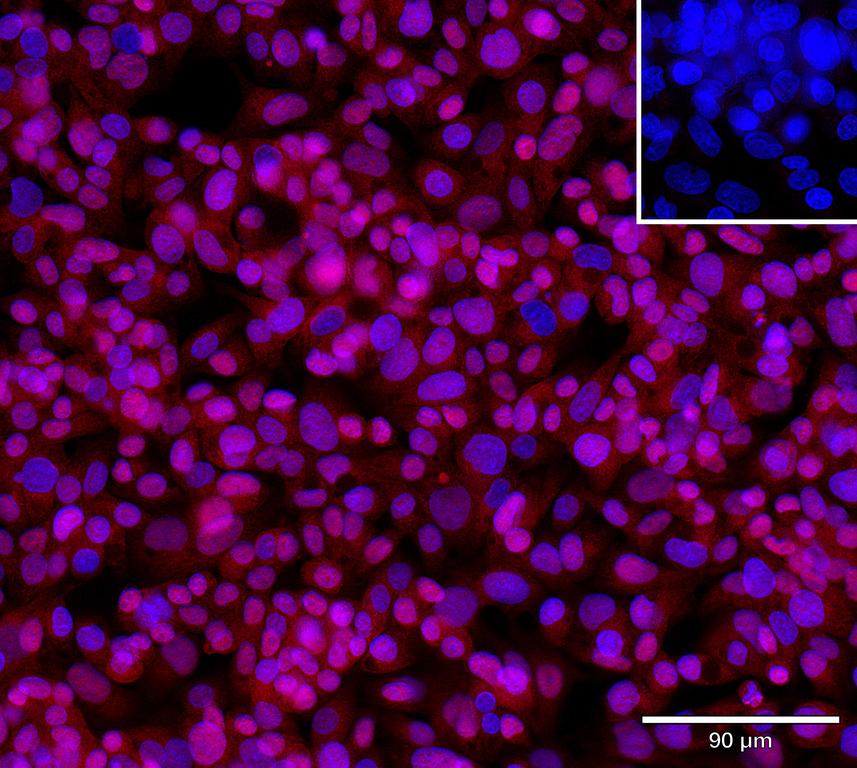 Ankyron SIGL7_HUMAN Clone FE40950