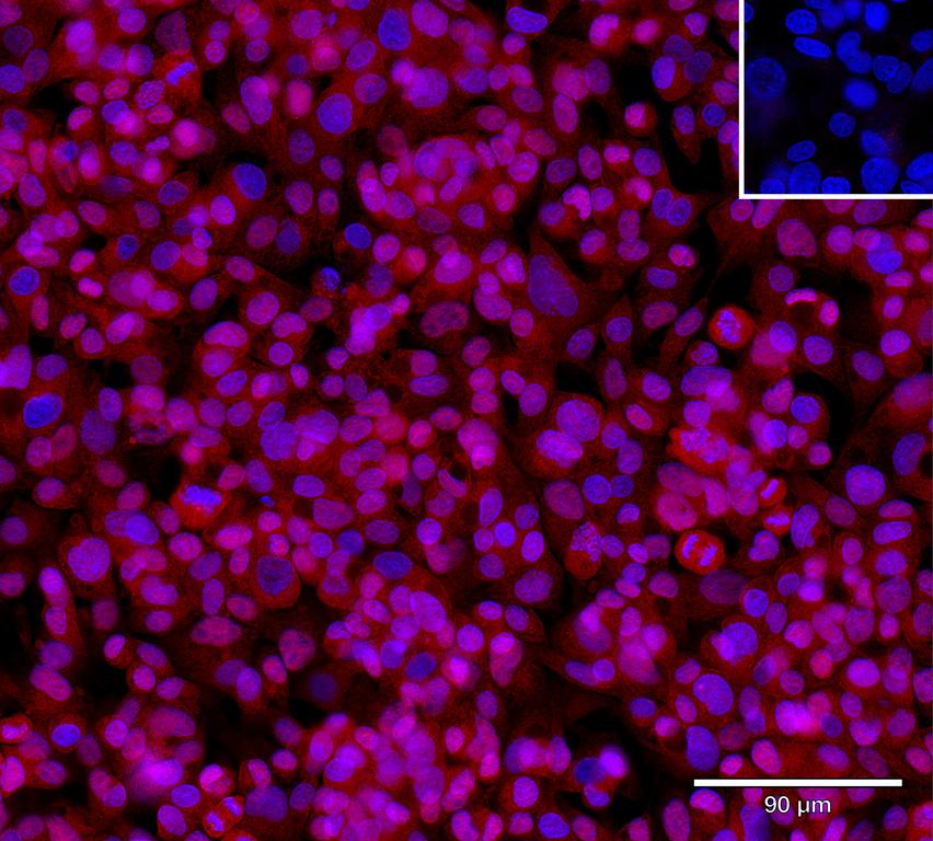 Ankyron SIGL7_HUMAN Clone FE40963