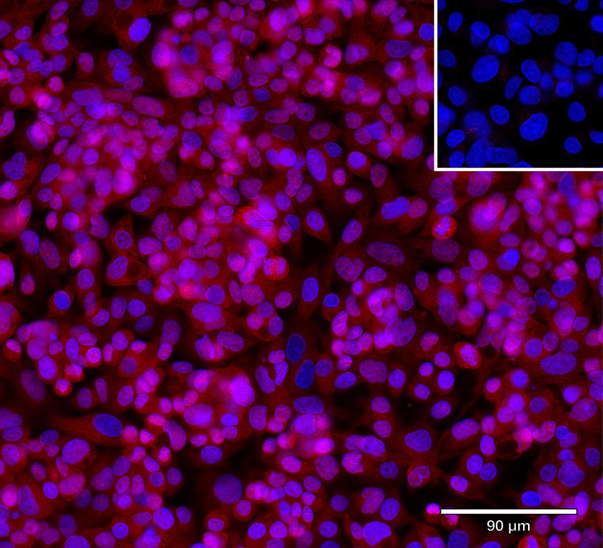 Ankyron SIGL7_HUMAN Clone FE40964