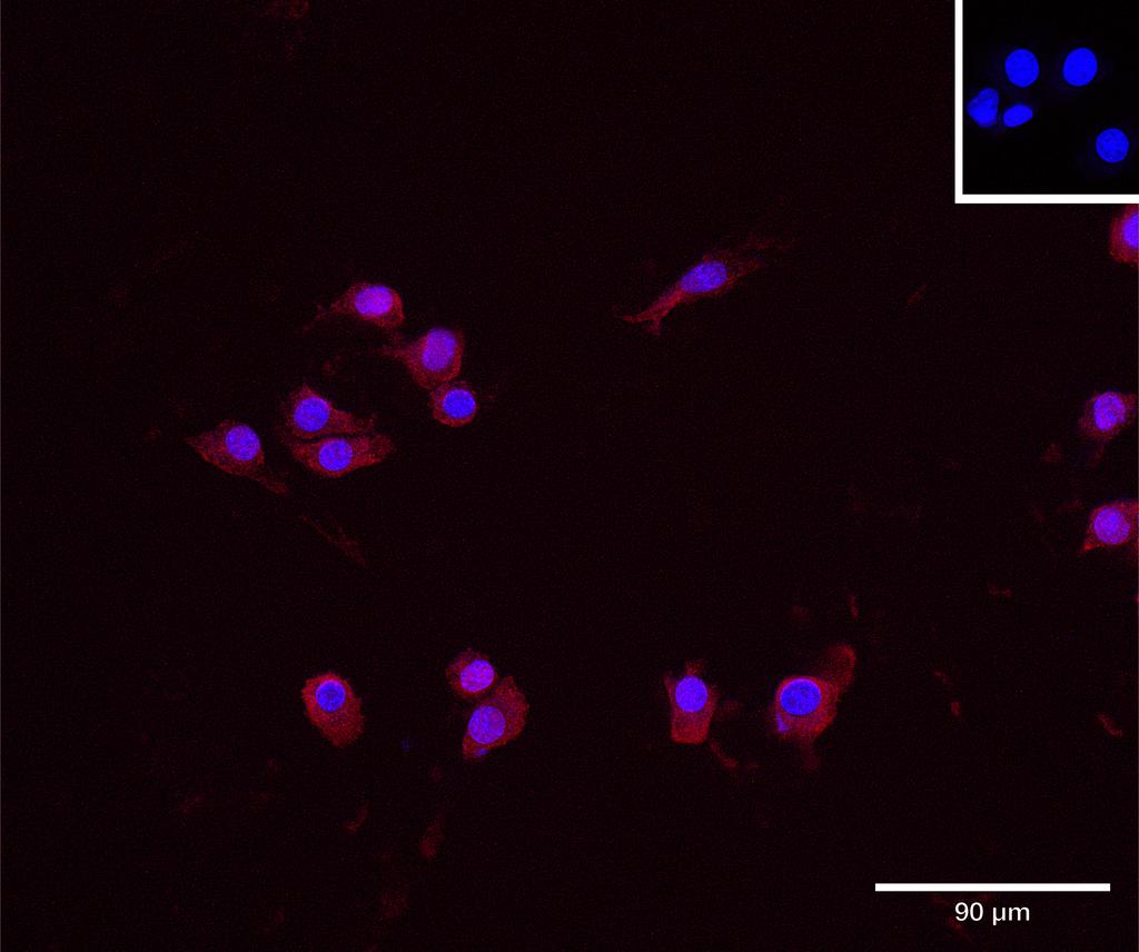 Ankyron SLAF6_MOUSE Clone DD40767