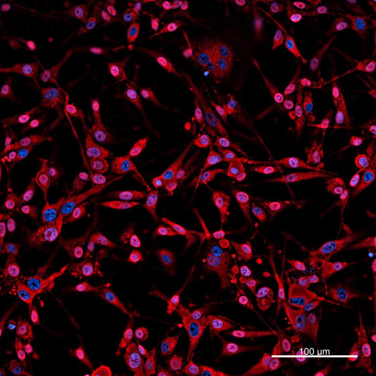 Ankyron SNP25_HUMAN Clone DB40564