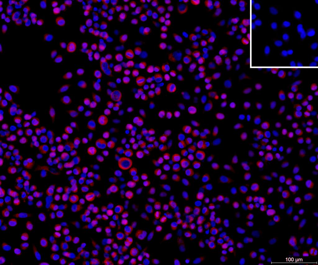 Ankyron SOCS3_HUMAN Clone DB40289