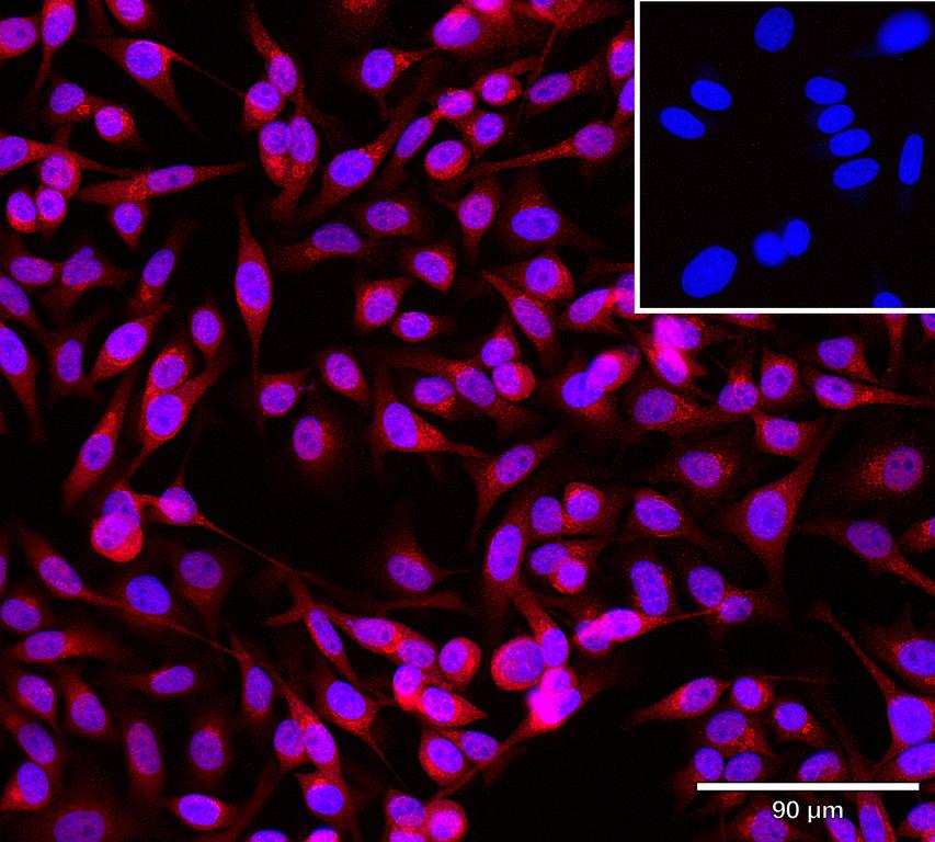 Ankyron SP140_HUMAN Clone DV40690