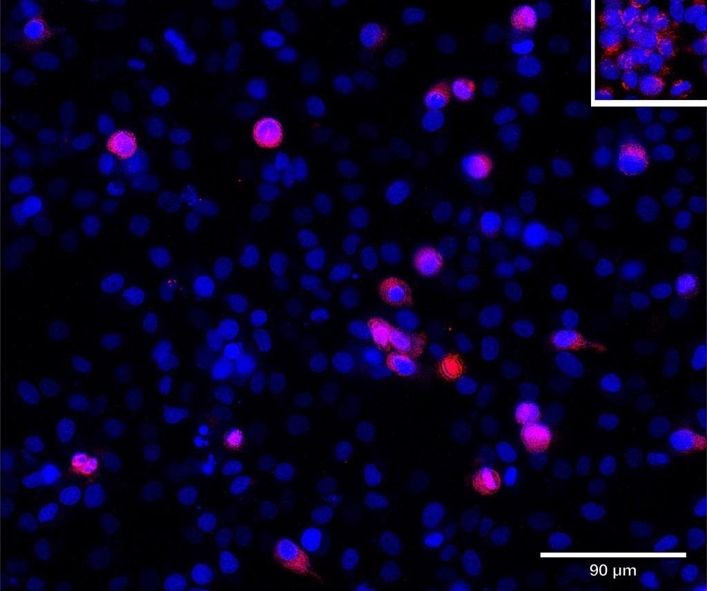 Ankyron SP1_HUMAN Clone BZ30149