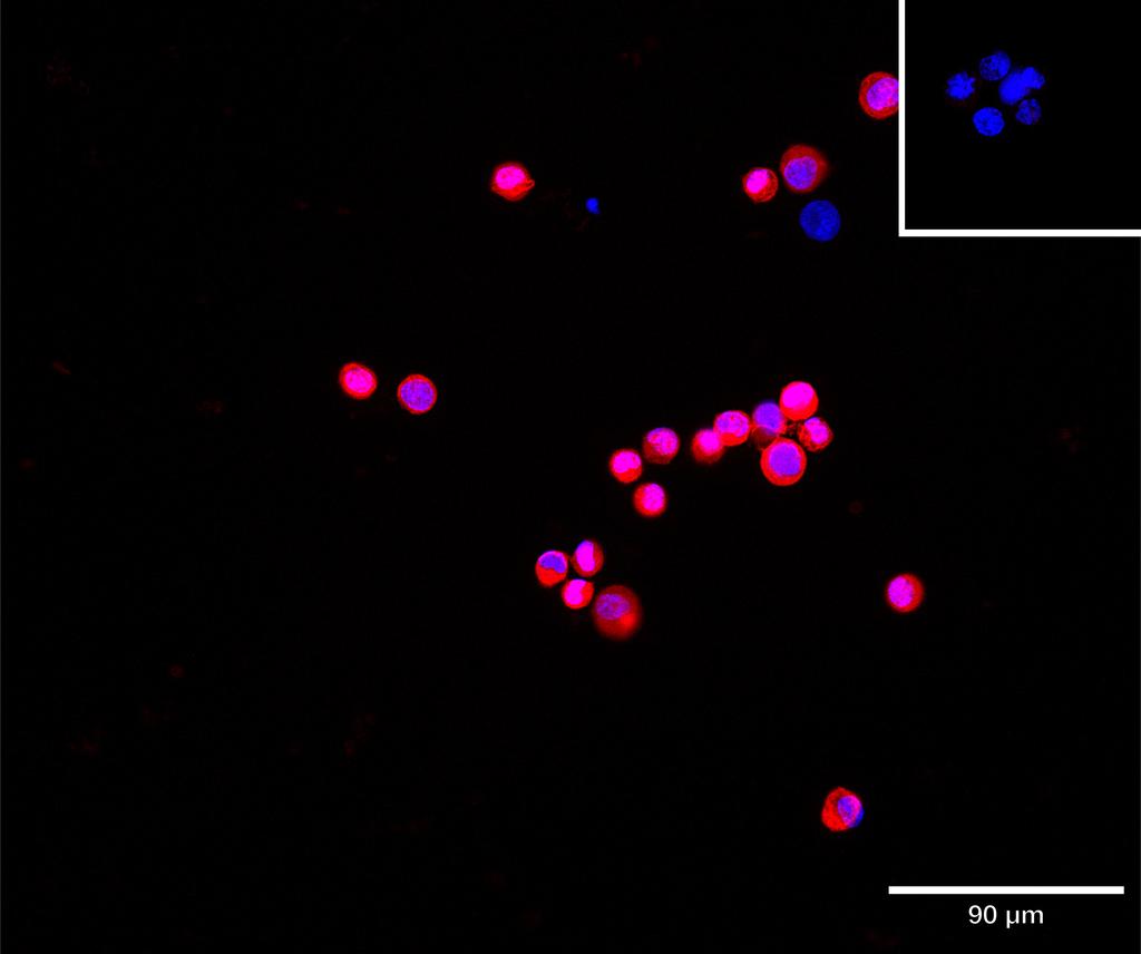 Ankyron SPA12_HUMAN Clone AW40676