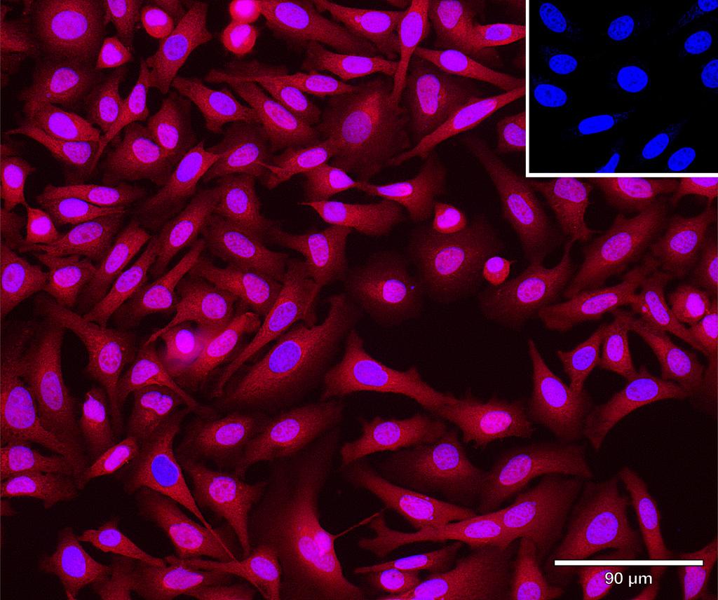 Ankyron SPB6_HUMAN Clone DE40990