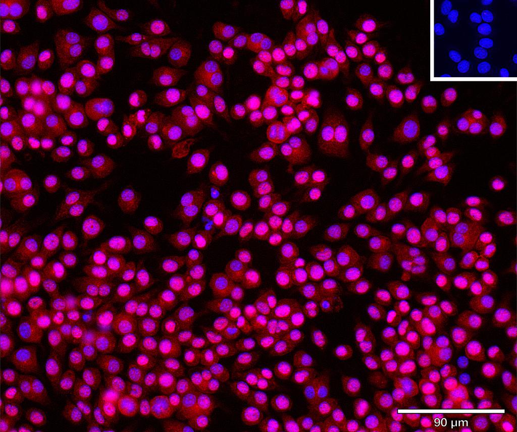 Ankyron SPRL1_MOUSE Clone AM40162