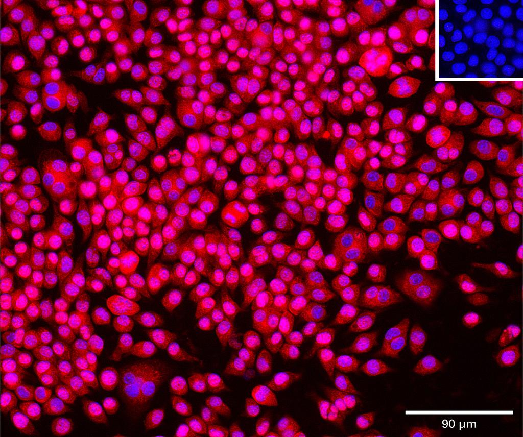 Ankyron SPRL1_MOUSE Clone AM40163