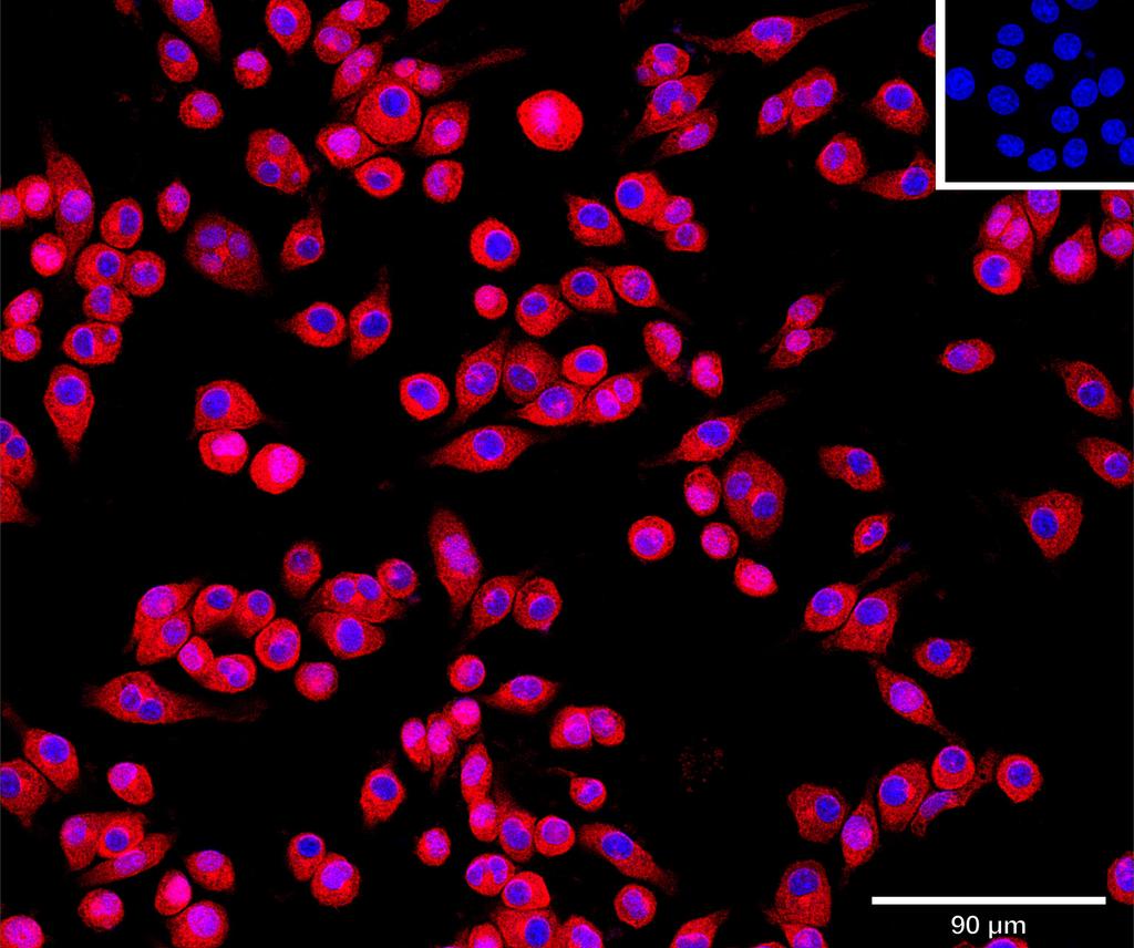 Ankyron SPRL1_MOUSE Clone AM40160