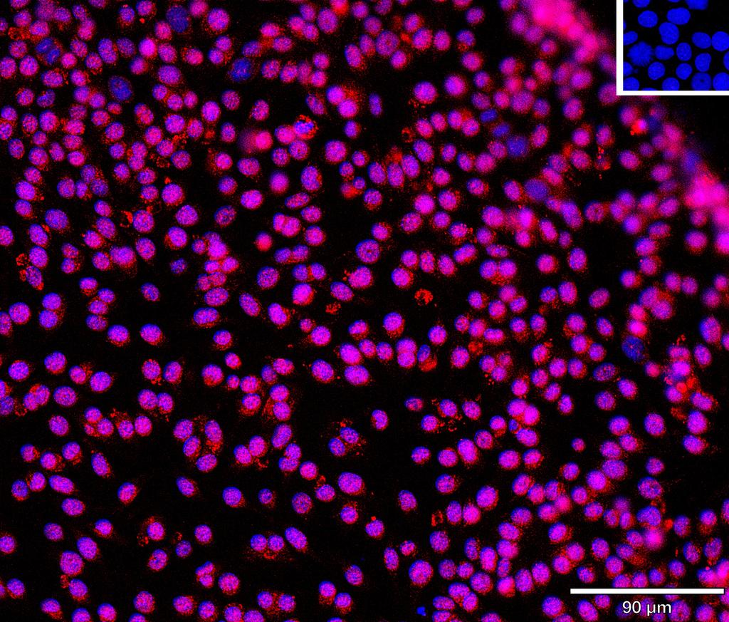 Ankyron STAT1_MOUSE Clone CK30290