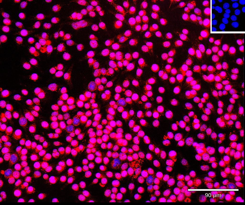 Ankyron STAT1_MOUSE Clone CK30296