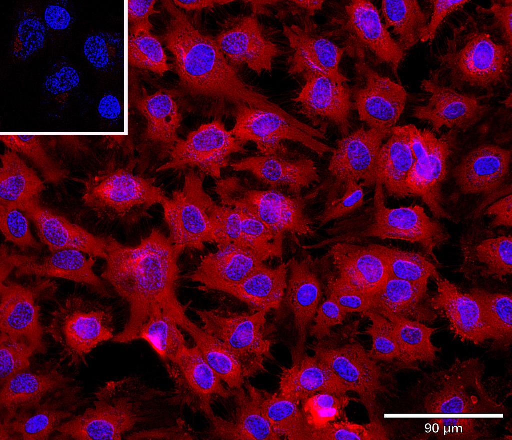 Ankyron STK4_HUMAN Clone AR40316