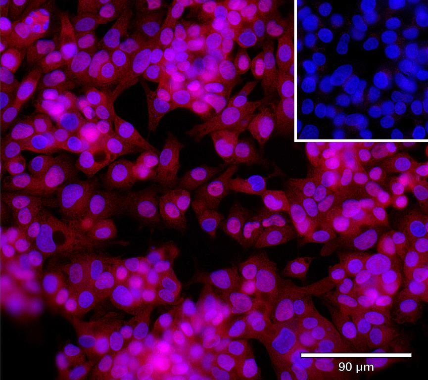 Ankyron STX7_HUMAN Clone AR40693