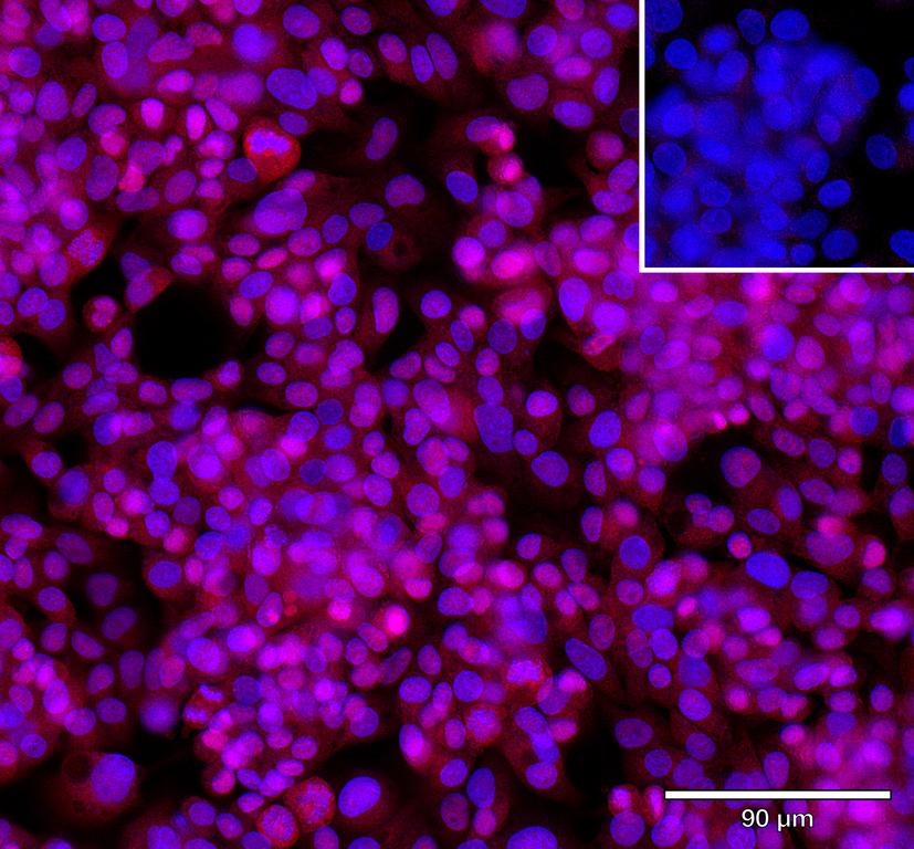 Ankyron STX7_HUMAN Clone AR40694