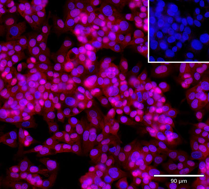 Ankyron STX7_HUMAN Clone AR40695