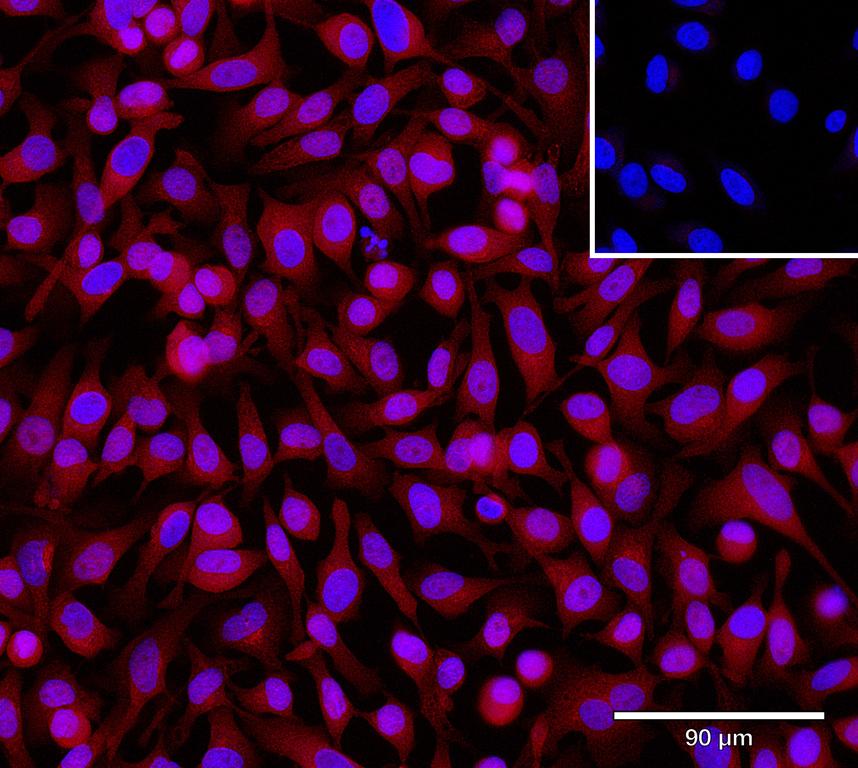 Ankyron STX8_HUMAN Clone DC41032
