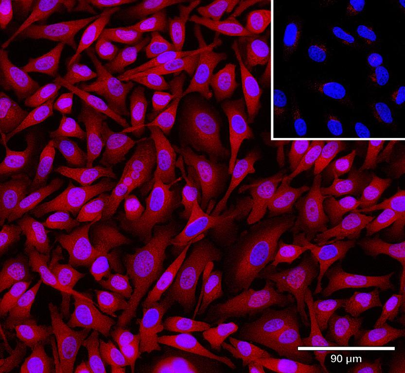 Ankyron SYDC_HUMAN Clone CW40542