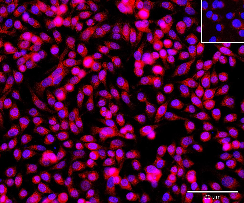 Ankyron TBCA_HUMAN Clone BA40919