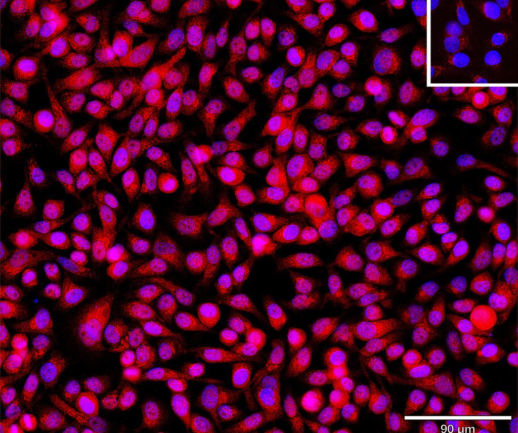Ankyron TBCA_HUMAN Clone BA40920