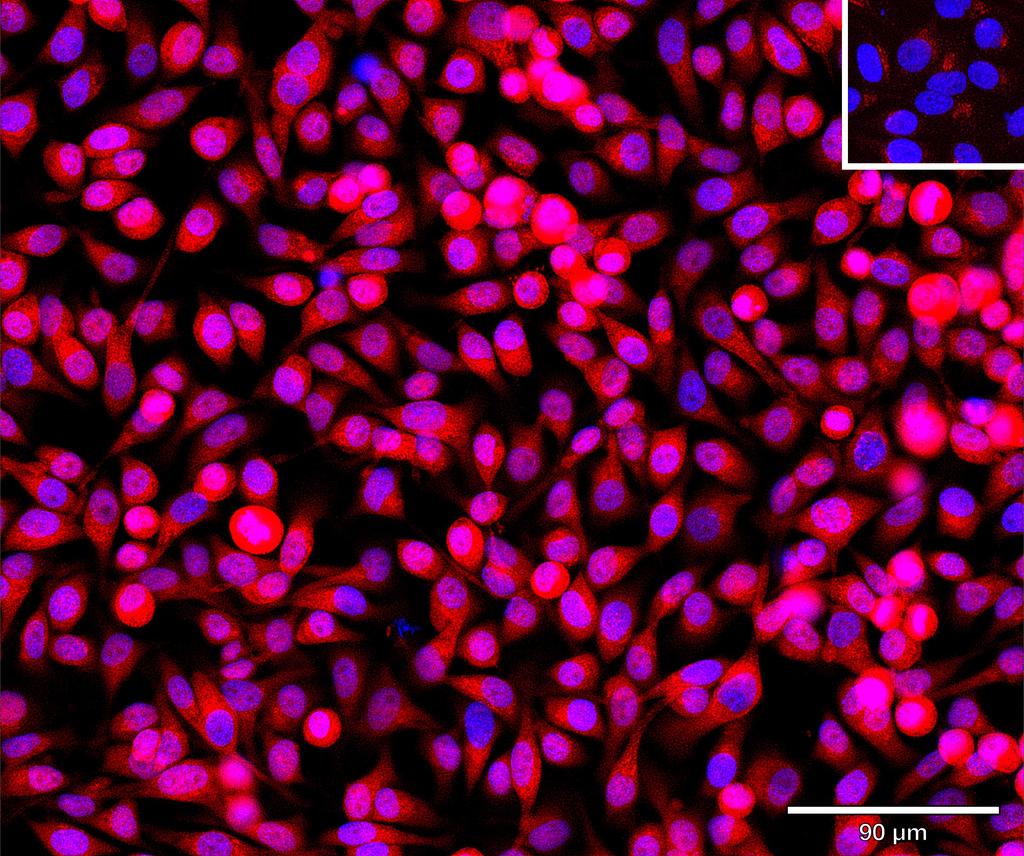 Ankyron TBCA_HUMAN Clone BA40921