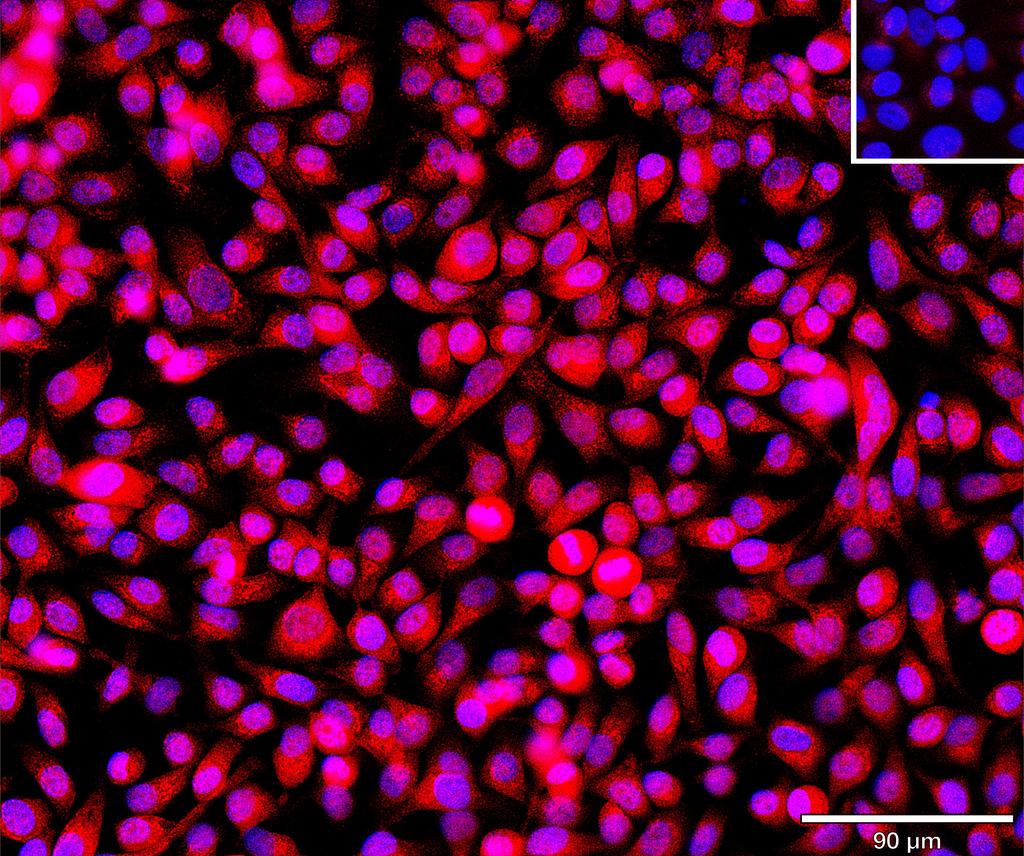 Ankyron TBCA_HUMAN Clone BA40924