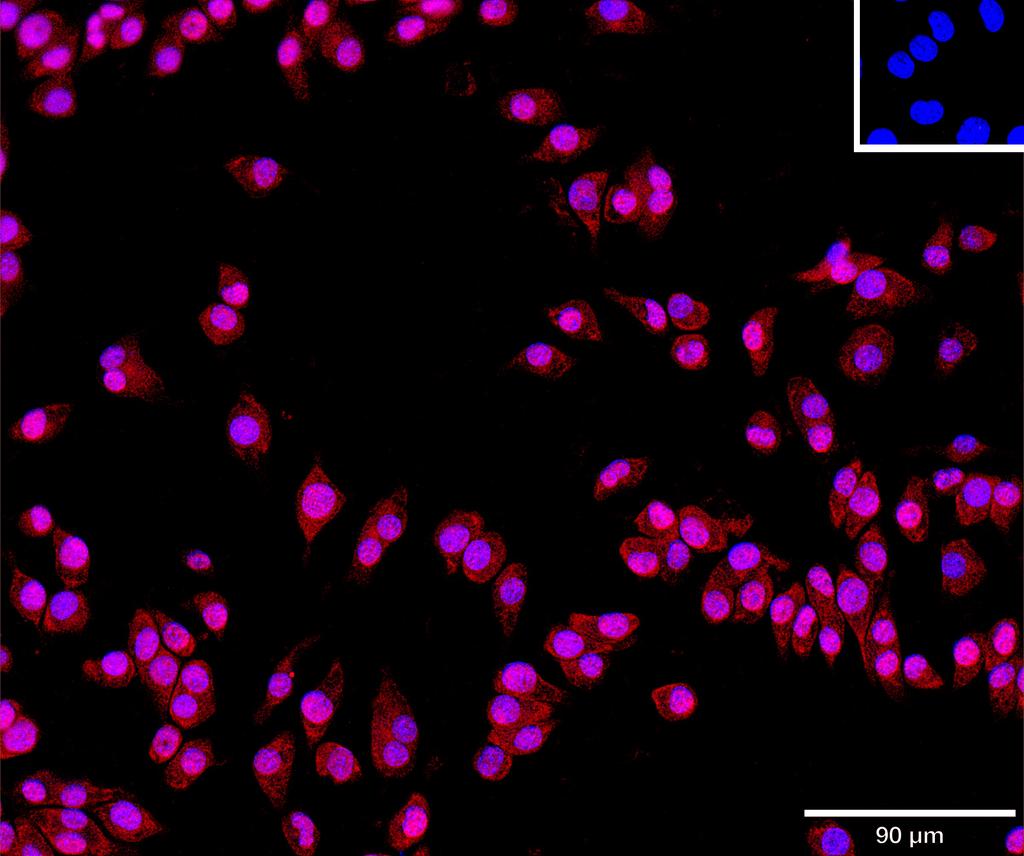 Ankyron TEFF1_MOUSE Clone AS40590