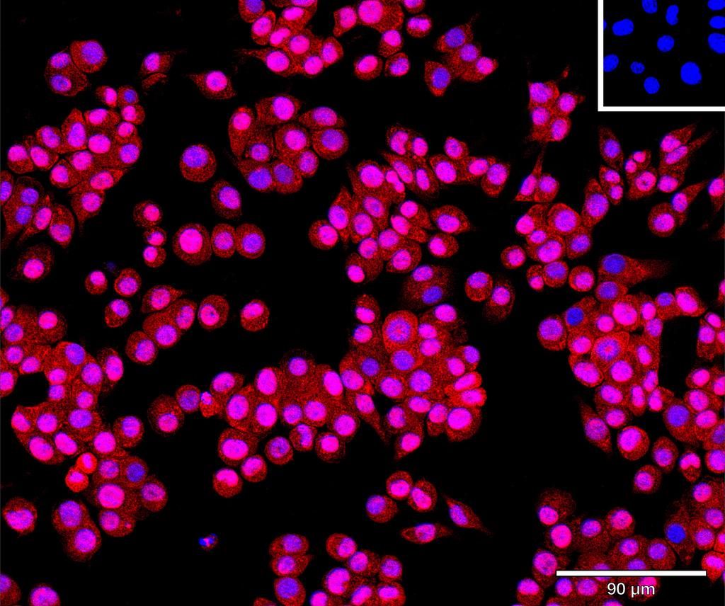 Ankyron TEFF1_MOUSE Clone AS40595