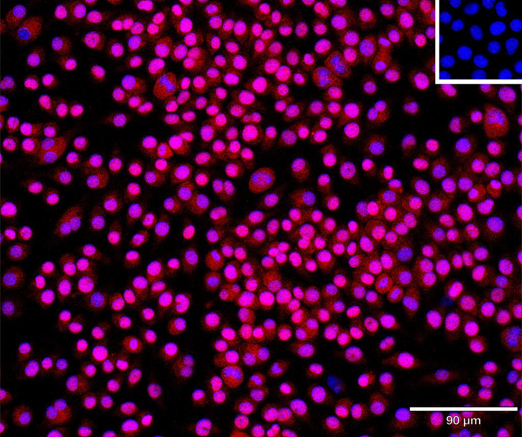 Ankyron TENA_MOUSE Clone BP40343