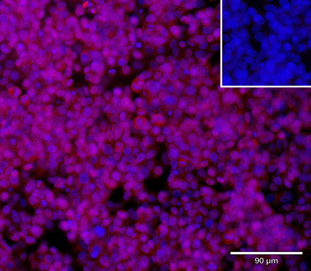 Ankyron TGBR3_HUMAN Clone DC40745