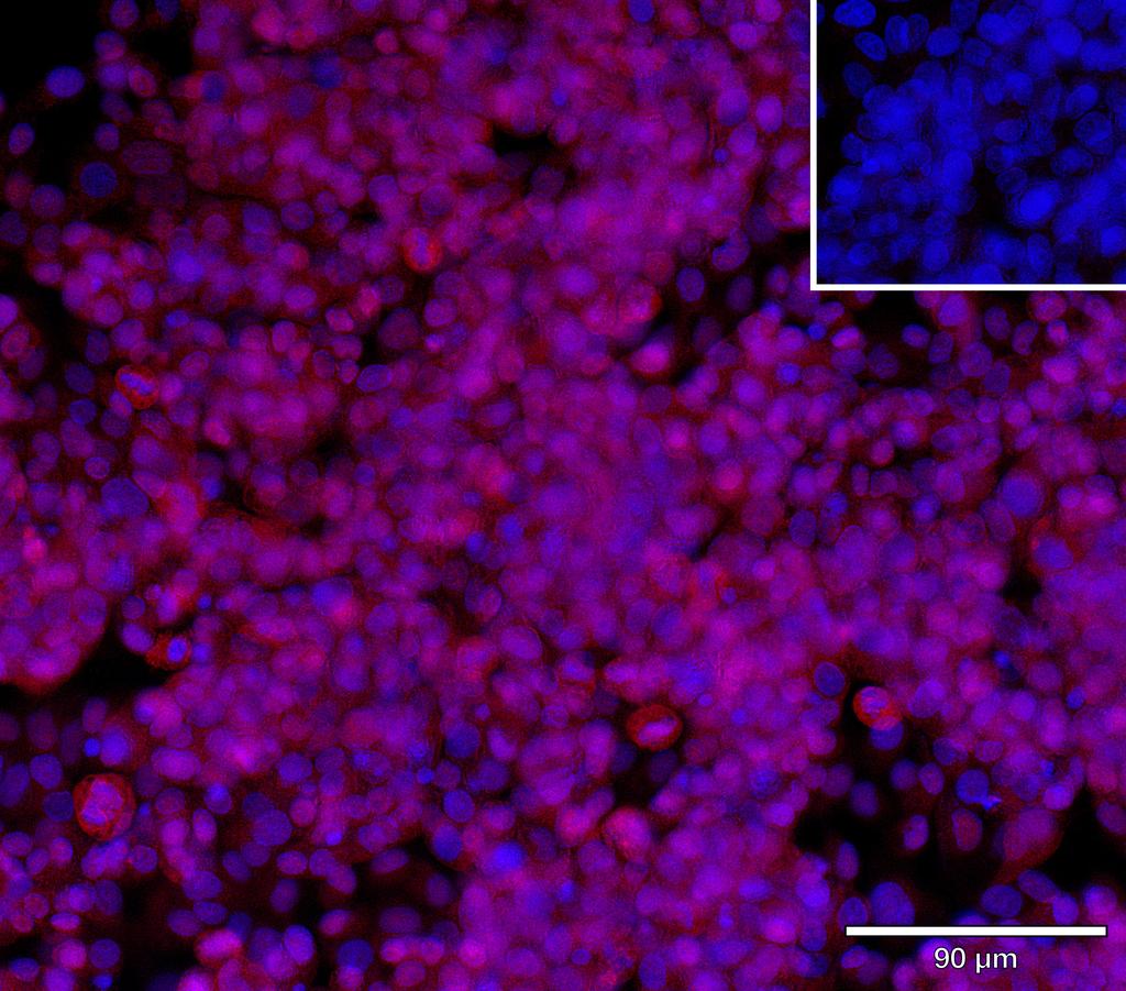 Ankyron TGBR3_HUMAN Clone DC40739