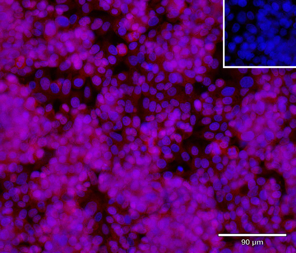 Ankyron TGBR3_HUMAN Clone EE30207