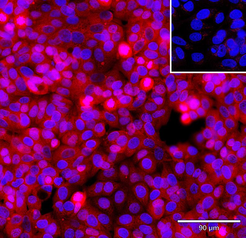 Ankyron TGFA_HUMAN Clone CD30279