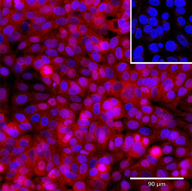 Ankyron TGFA_HUMAN Clone CD30277