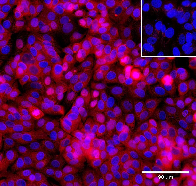 Ankyron TGFA_HUMAN Clone CD30280