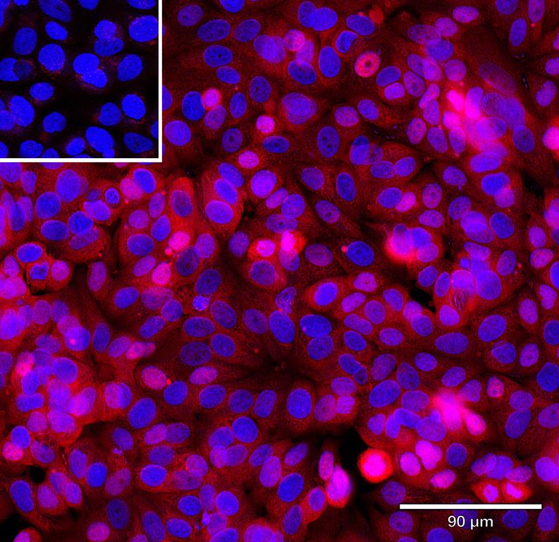 Ankyron TGFA_HUMAN Clone CD30274
