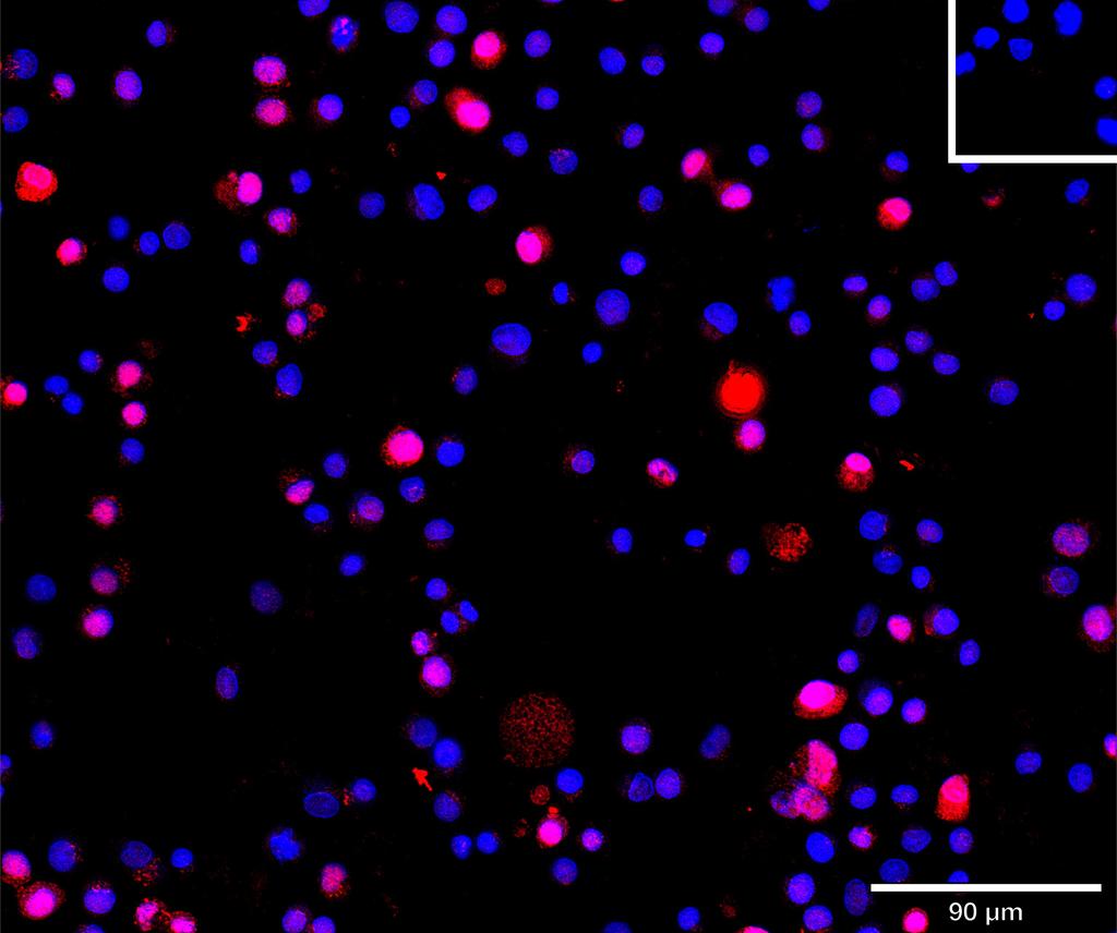 Ankyron TGFR2_HUMAN Clone EC30457
