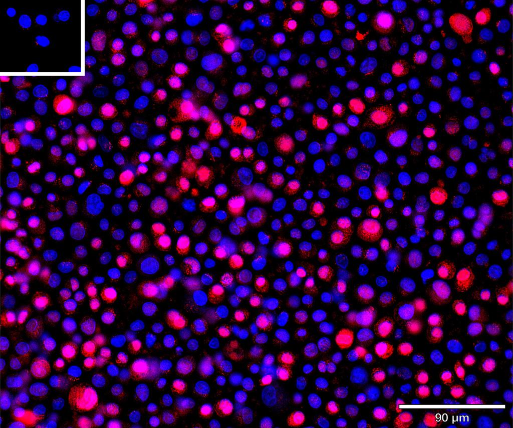 Ankyron TGFR2_HUMAN Clone EC30458