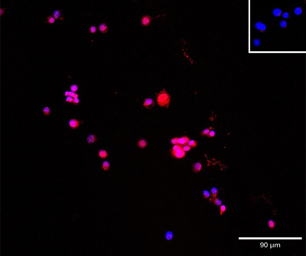 Ankyron TGFR2_HUMAN Clone EC30459