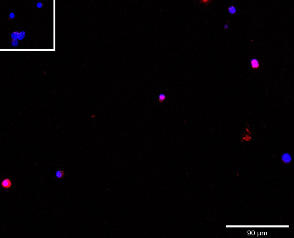 Ankyron TGFR2_HUMAN Clone EC30460