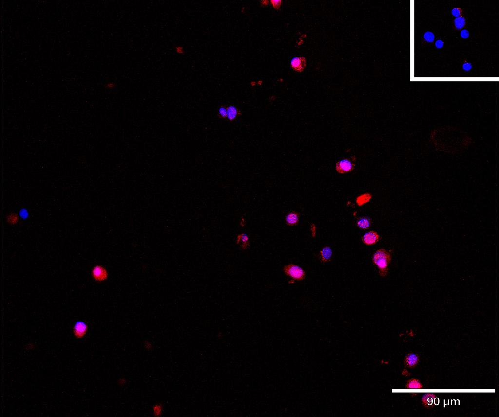 Ankyron TGFR2_HUMAN Clone EC30461