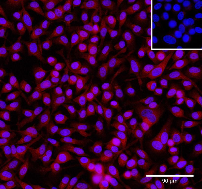 Ankyron TGM2_HUMAN Clone DC40568