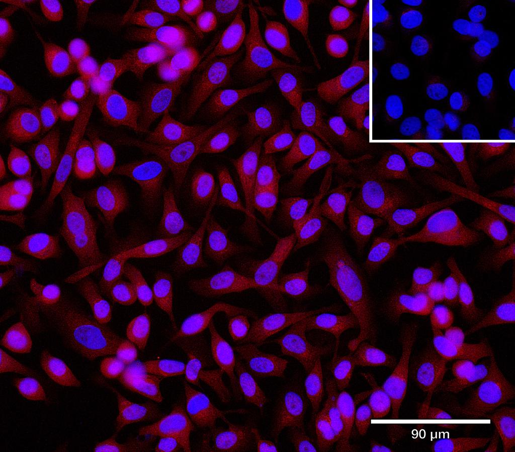 Ankyron TGM2_HUMAN Clone DC40555