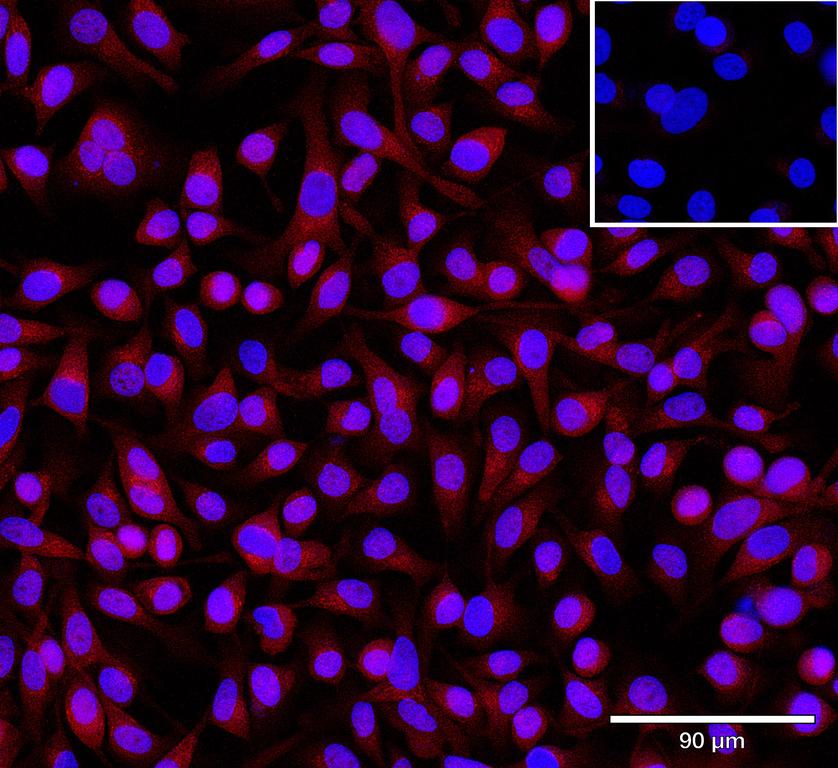 Ankyron TGM2_HUMAN Clone DC40564