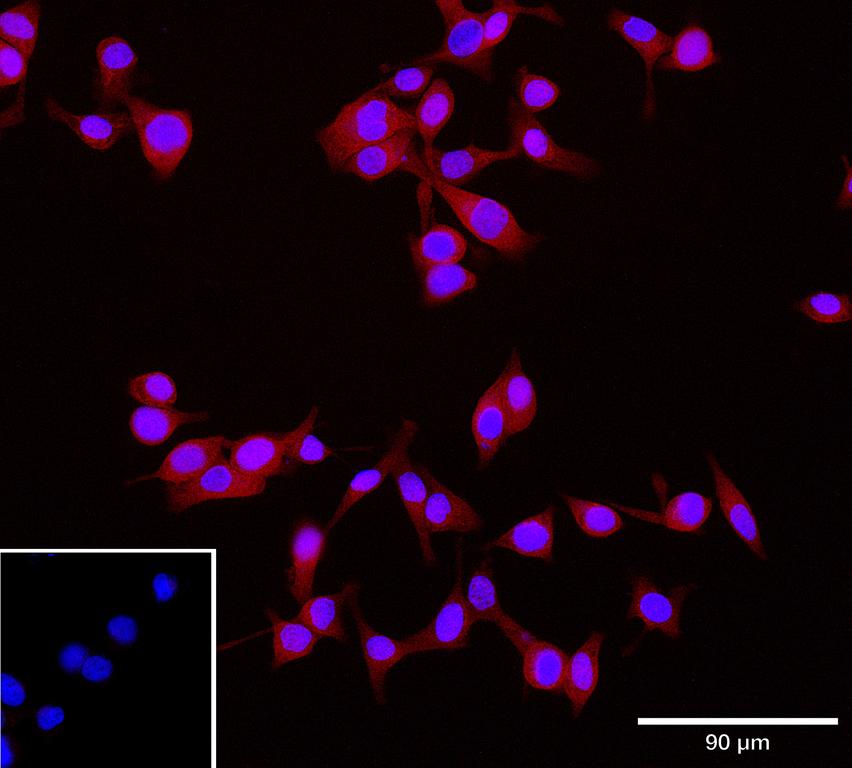Ankyron TGM2_HUMAN Clone DC40561