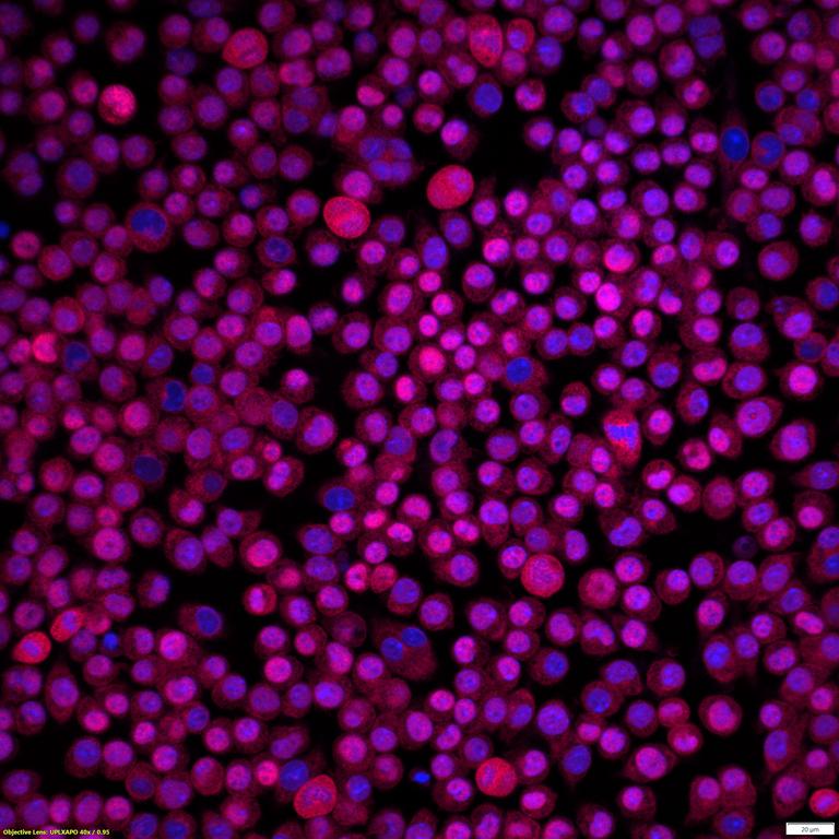 Ankyron TNF11_MOUSE Clone AS40674